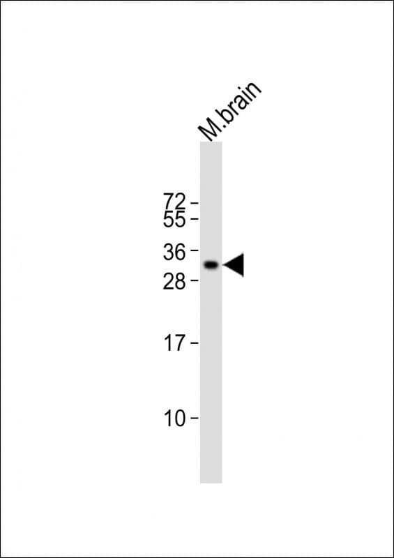 PPP1R1B / DARPP-32 Antibody (aa106-139)
