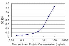GTF3A Antibody (clone 4G4)