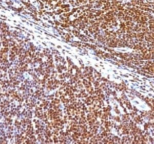 SUMO1 / SMT3 Antibody (clone S1MT-2)