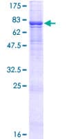 Human ENDOD1 Protein (Recombinant GST)
