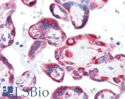 PathPlus™ KCNJ2 / Kir2.1 Antibody (Internal)
