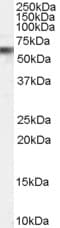 IHC-plus™ VPS45 Antibody (aa558-570)