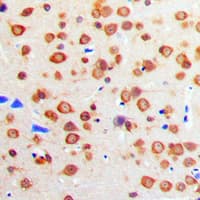 Polyclonal Rabbit anti-Human IGF1R / IGF1 Receptor Antibody (C-Terminus, IHC, WB)