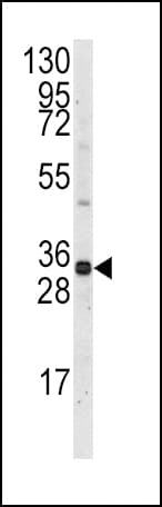 MCL1 / MCL 1 Antibody (aa191-226)
