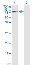 Monoclonal Mouse anti-Human GLB1 / Beta-Galactosidase Antibody (clone 6E7, WB)