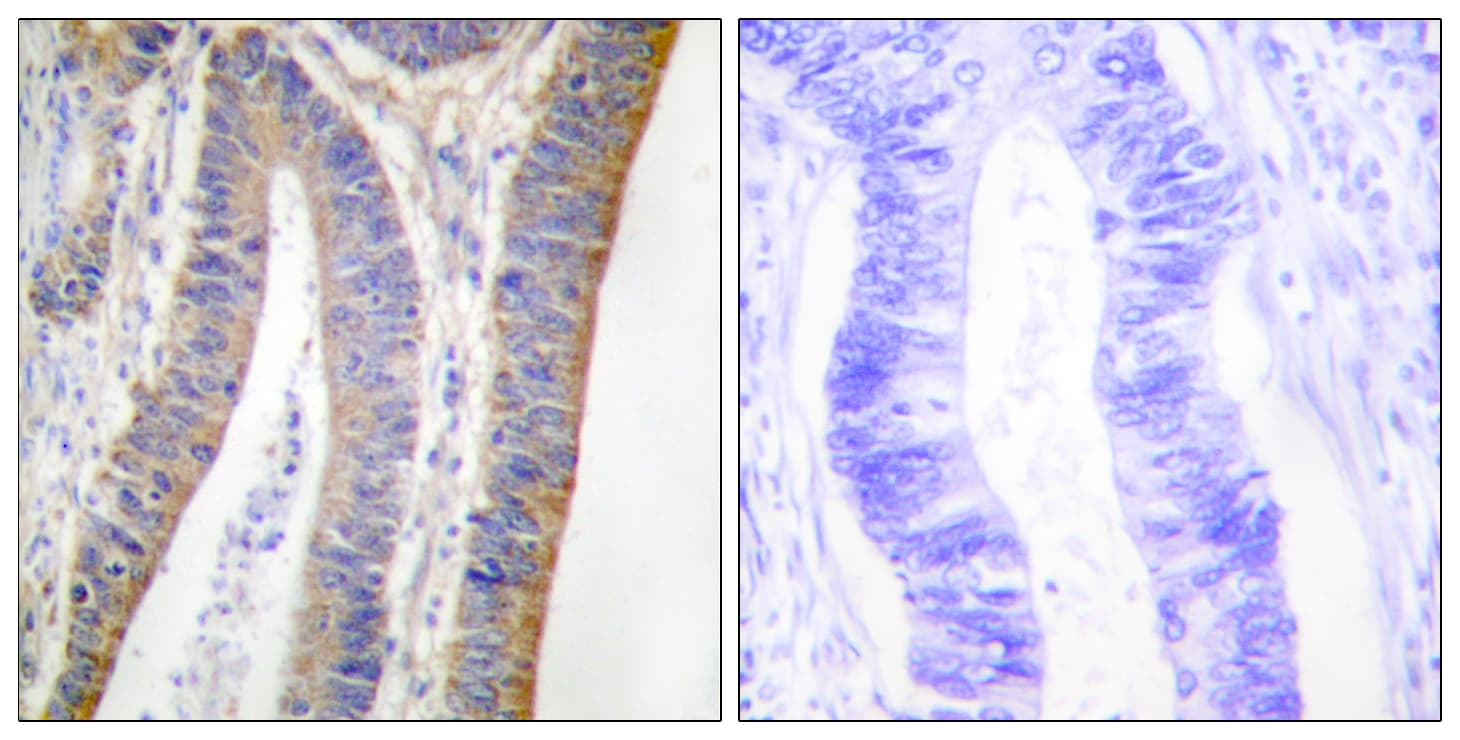 Polyclonal Rabbit anti-Human NCF1 / p47phox / p47 phox Antibody (phospho-Ser359, IHC, IF, WB)