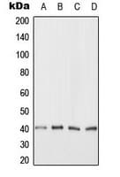 Polyclonal Rabbit anti-Human CARP / ANKRD1 Antibody (C-Terminus, IHC, WB)
