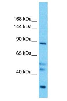 PCDHGB5 Antibody (aa361-410)