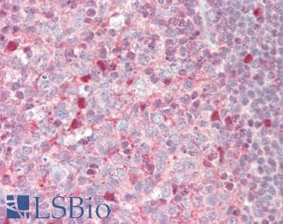 Polyclonal Rabbit anti-Human SERPINB9 / PI9 Antibody (aa122-150, IHC, WB)