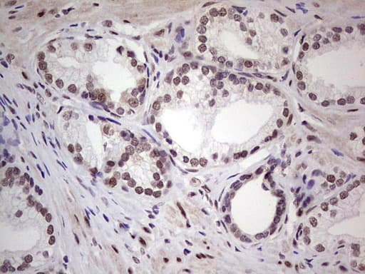 Monoclonal Mouse anti-Human ERCC1 Antibody (clone OTI2H1, IHC, WB)
