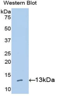 HMGIY / HMGA1 Antibody (aa1-107)