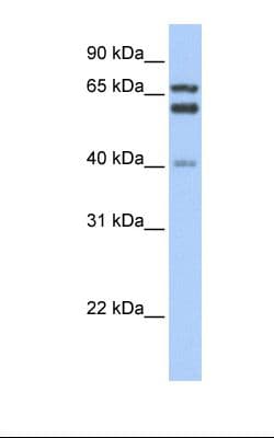 GCLC Antibody (aa74-123)
