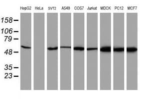 AKT1 Antibody (clone OTI4E10)