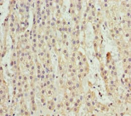 Polyclonal Rabbit anti-Human RFFL Antibody (IHC)