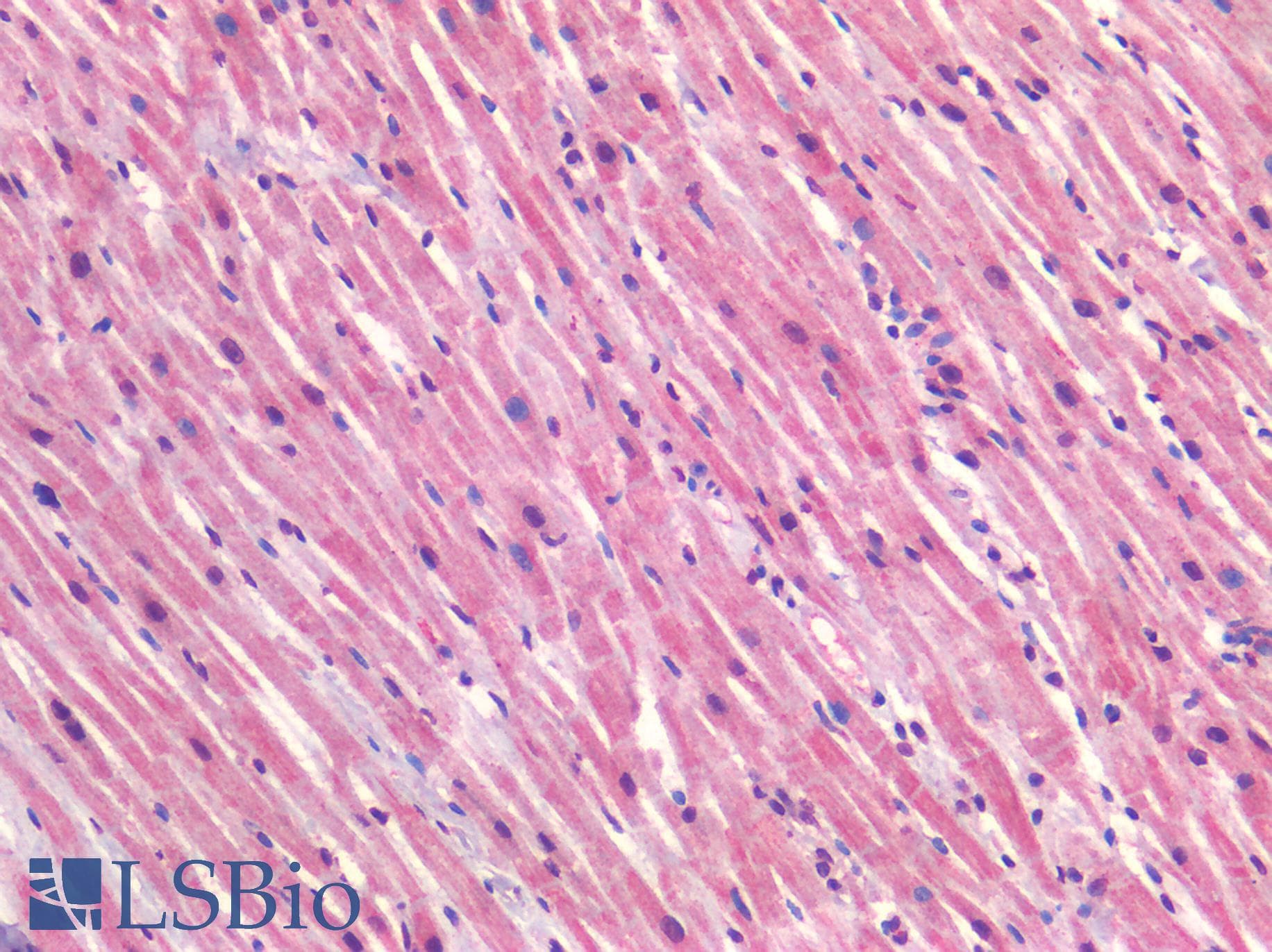 IHC-plus™ CAV1 / Caveolin 1 Antibody (N-Terminus)