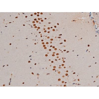 GATA1 Antibody (phospho-Ser142)