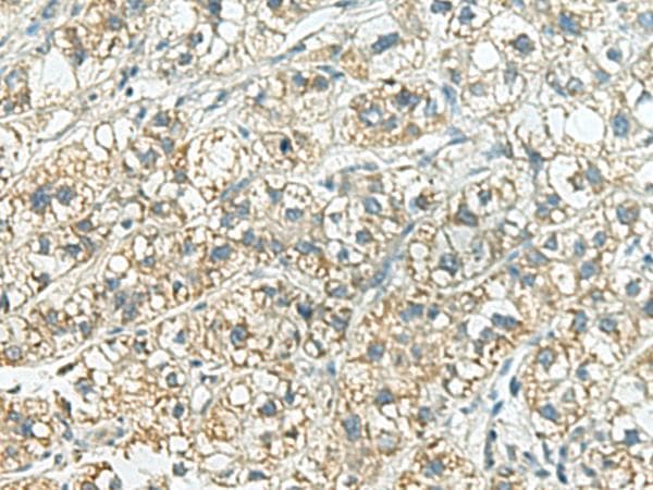 SORBS2 / ARGBP2 Antibody