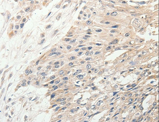 SLC9A7 Antibody