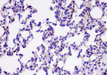 Polyclonal Rabbit anti-Human TIMM17A / TIM17 Antibody (IHC, WB)