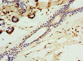 Polyclonal Rabbit anti-Human CALCB Antibody (aa1-127, IHC)