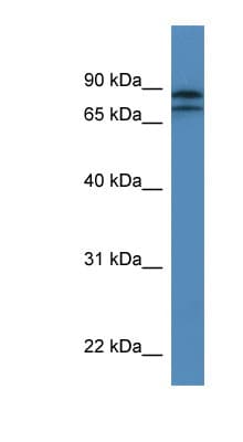 KLHL22 Antibody (aa175-224)