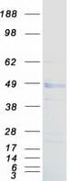 Human LOX / Lysyl Oxidase Protein (Recombinant Myc-DDK (Flag))