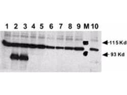 NOTCH1 Antibody (N-Terminus)