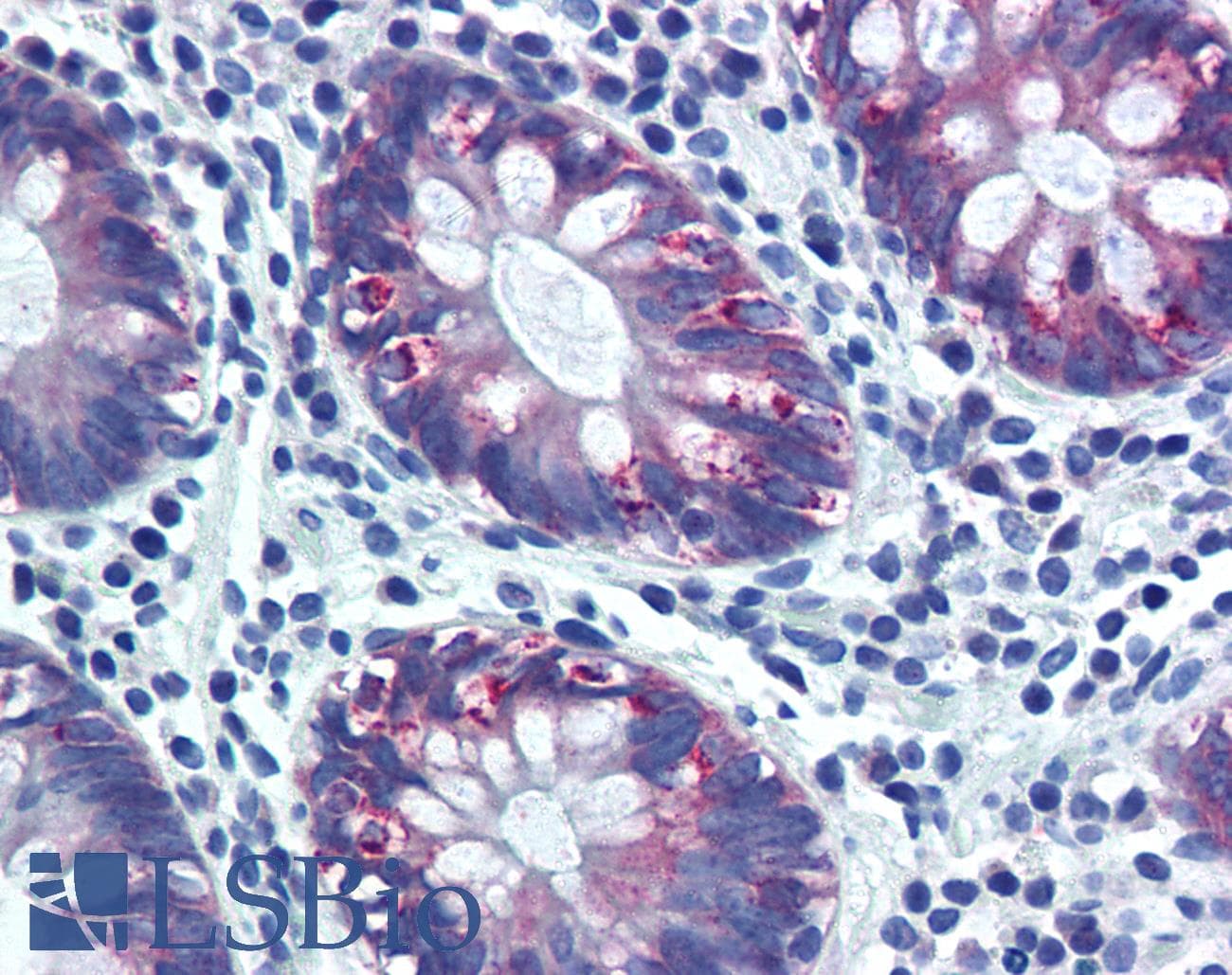IHC-plus™ AGR2 Antibody (aa55-72)