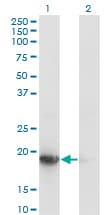 UBE2G1 Antibody (clone 1C12-1B2)