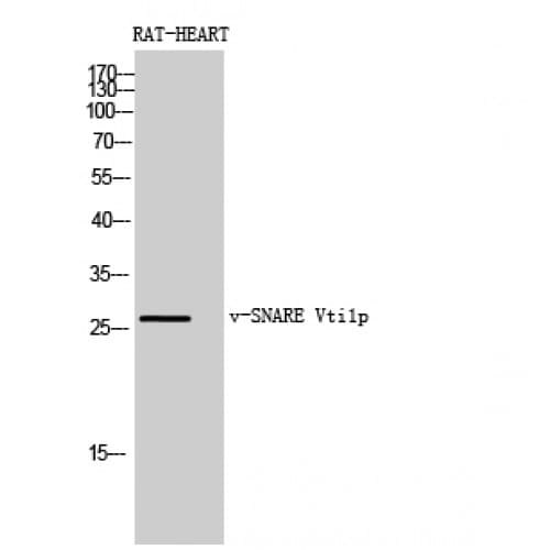 Polyclonal Rabbit anti-Human VTI1B Antibody (Internal, WB)