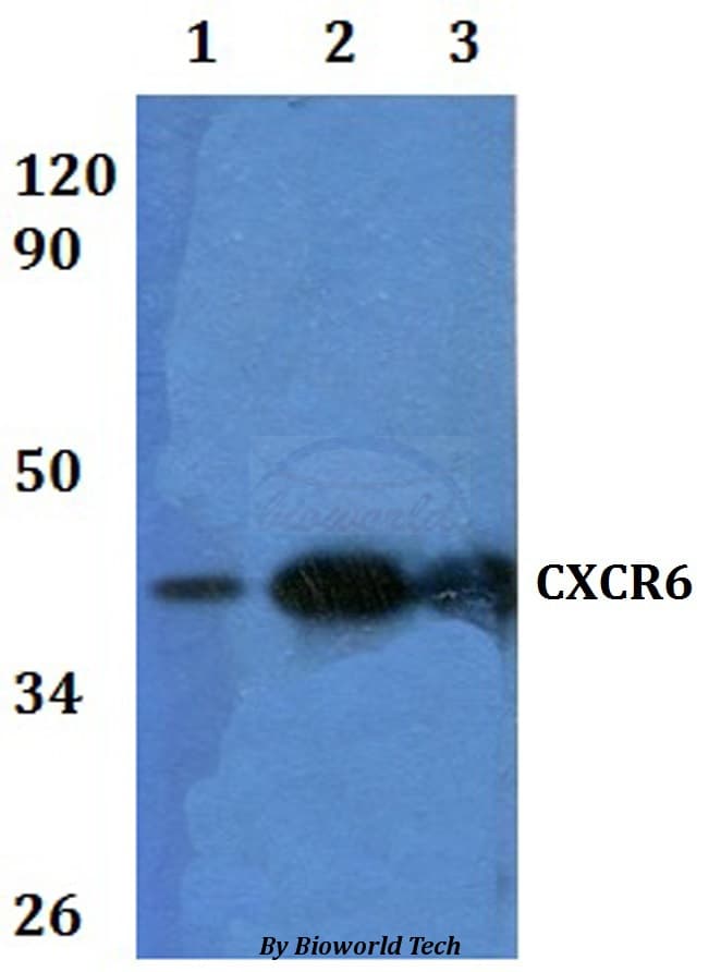 Polyclonal Rabbit anti-Human CXCR6 Antibody (WB)