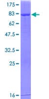 Human RALDH2 / ALDH1A2 Protein (Recombinant GST)