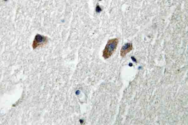 Polyclonal Rabbit anti-Human CaMKII Beta+Gamma+Delta Antibody (Ser280, IHC, WB)