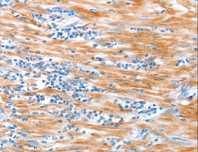 Polyclonal Rabbit anti-Human ALDOB Antibody (IHC, WB)
