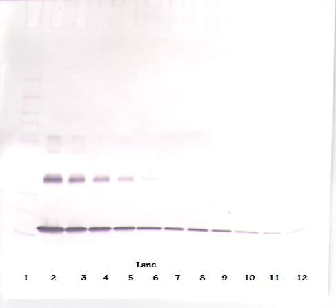 IL1A / IL-1 Alpha Antibody