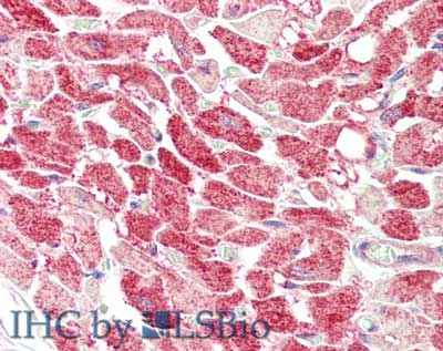CENPU / MLF1IP Antibody
