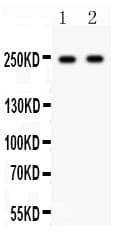 CACNA1D / Cav1.3 Antibody (aa1-180)