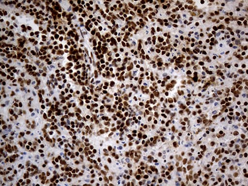 HNRNPH1 / hnRNP H Antibody (clone OTI2E8)
