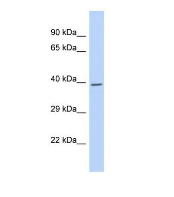Polyclonal Rabbit anti-Human NR2E3 / PNR Antibody (aa166-215, WB)
