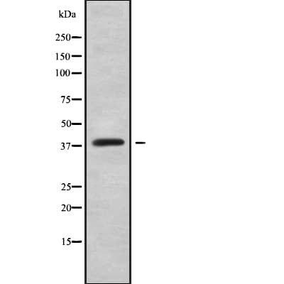 Polyclonal Rabbit anti-Human HOXC10 Antibody (WB)