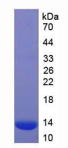 Mouse CCL7 / MCP3 Protein (Recombinant His)