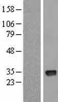 CTDSPL Protein (Over-Expression Lysate Myc-DDK (Flag))