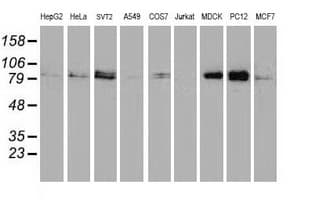IHC-plus™ STAT5A Antibody (clone 4E7)