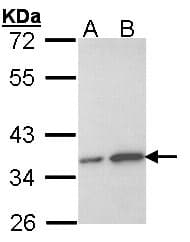Polyclonal Rabbit anti-Human OTUB1 / OTU1 Antibody (aa1-149, WB)
