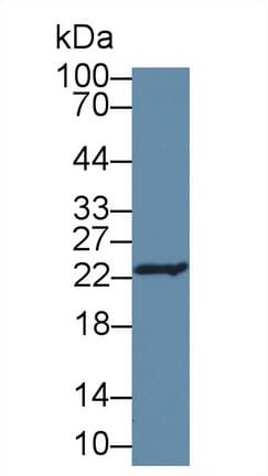 GSTP1 / GST Pi Antibody (aa1-210, APC)