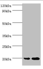 Polyclonal Rabbit anti-Human ARF6 Antibody (aa1-175, IHC, WB)