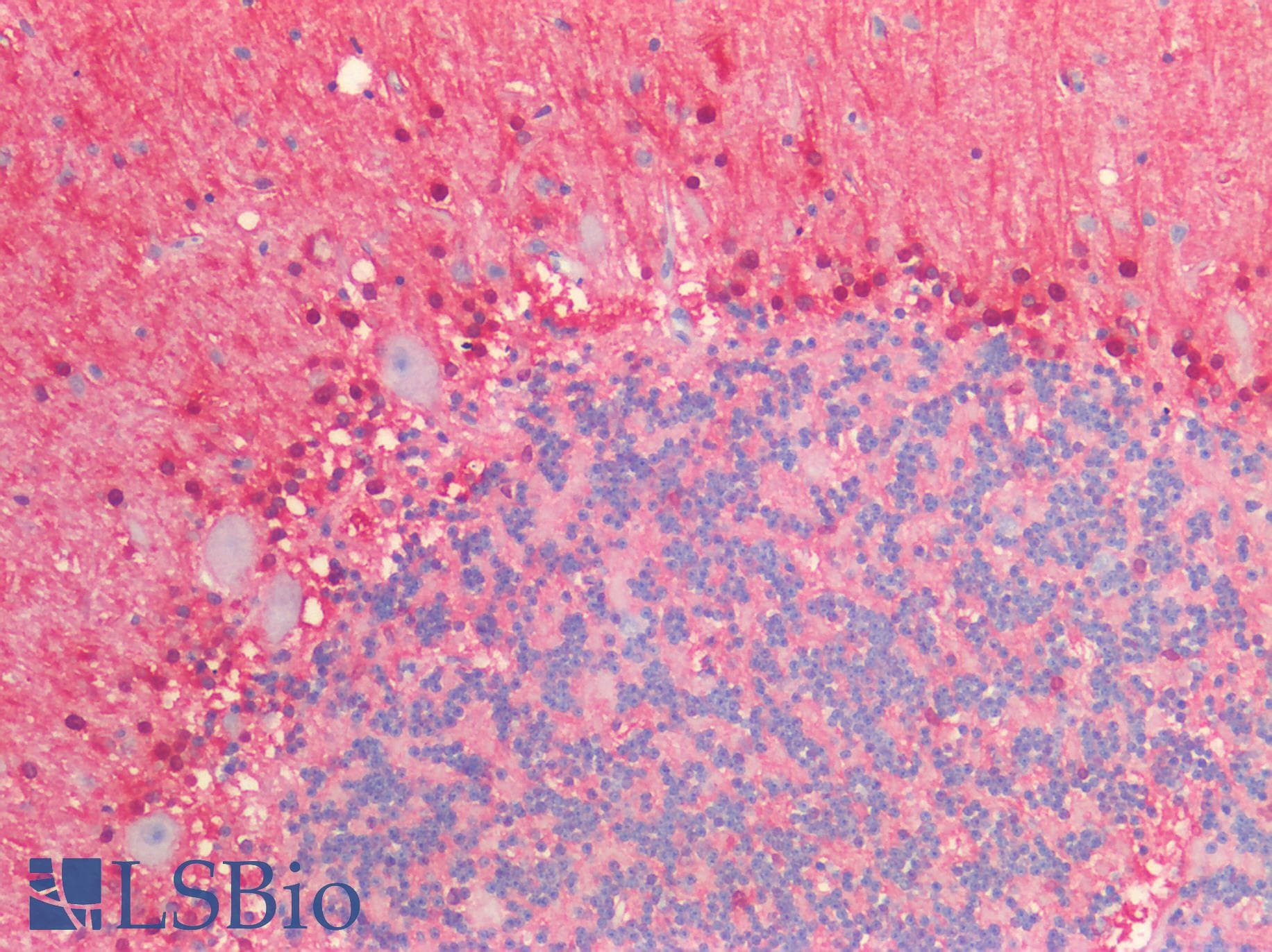 IHC-plus™ S100B / S100 Beta Antibody (clone SA-12)