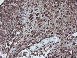 Monoclonal Mouse anti-Human SKIL / SNO / SnoN Antibody (clone OTI3E2, IHC, WB)