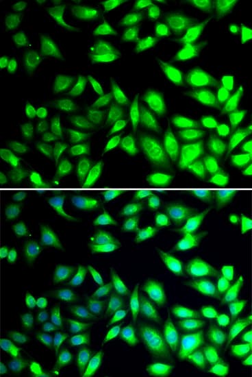 PDIA6 / ERP5 Antibody