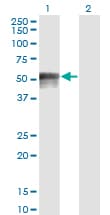 Monoclonal Mouse anti-Human FOXA1 Antibody (clone 1B1, IHC, IF, WB)